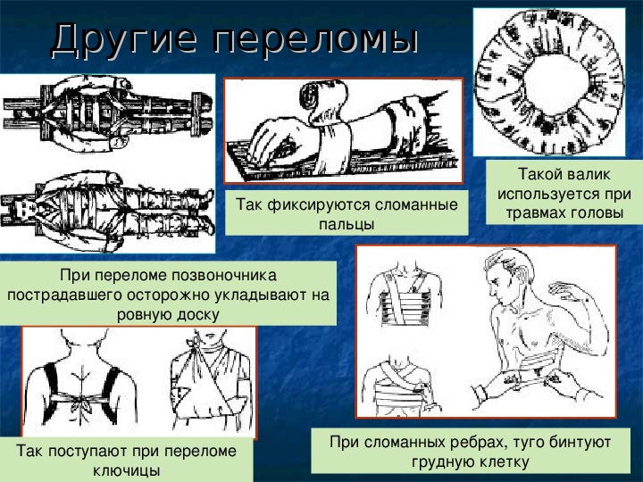 Первая помощь при травмах биология 8 класс презентация