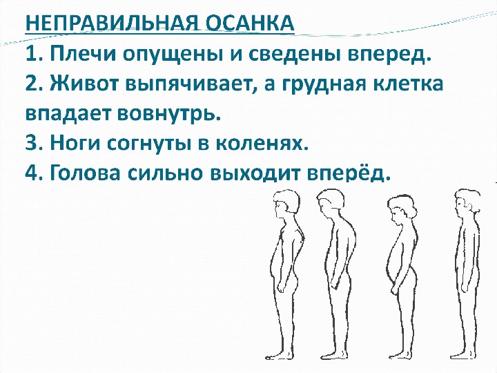 Мышцы осанки. Правильная осанка у человека. Интересный факт о осанки человека. Какая бывает осанка у человека. Осанка древнего человека.