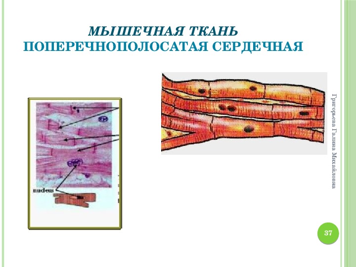 В чем особенность строения поперечнополосатой мышечной ткани. Поперечнополосатая и гладкая мышечная ткань. Схема строения сердечной поперечнополосатой мышечной ткани.. Поперечнополосатая Скелетная мышечная ткань препарат рисунок. Поперечно полосатая мышечная ткань гистология.