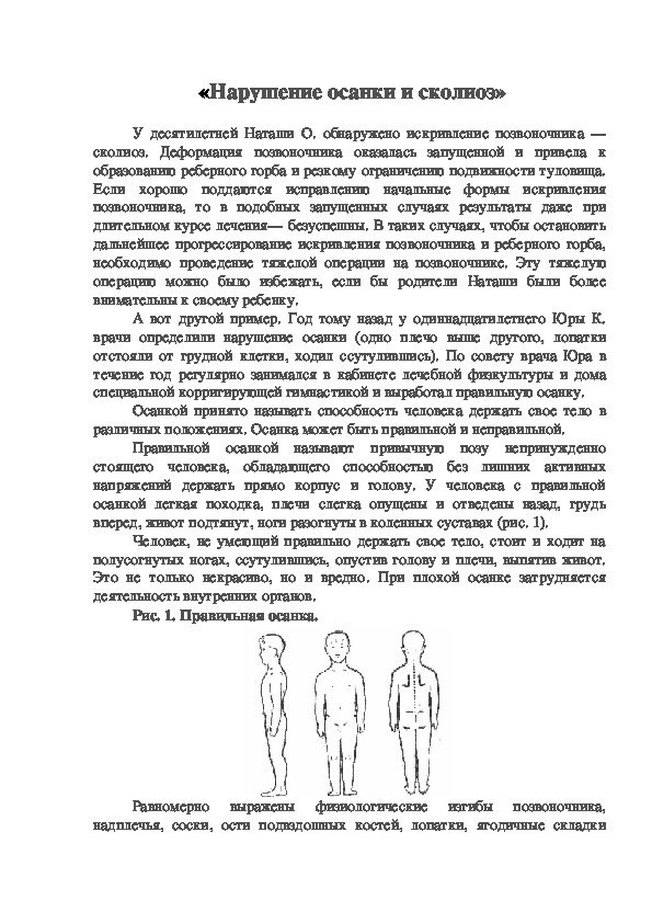 Обложка для материала Нарушение осанки и сколиоз
