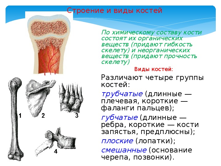 Виды костей. Виды костей животных. Опорные системы животных 6 класс. Опорные системы растений. Ковид кости