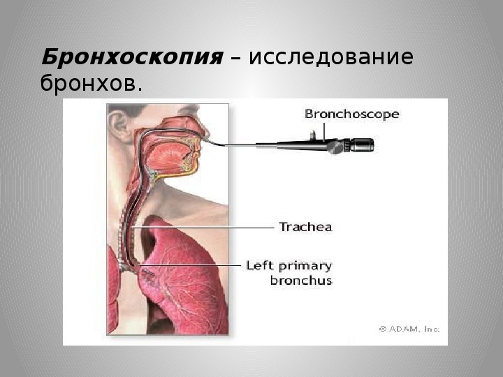 Лечебная бронхоскопия. Бронхоскопия эндоскопическое исследование бронхов. Инструментальный метод исследования бронхоскопии.