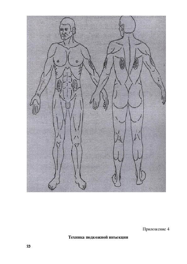 Анатомические места для внутрикожной инъекции