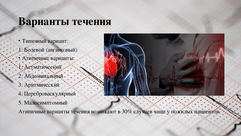 Абдоминальная форма инфаркта миокарда. Цереброваскулярный инфаркт. Аритмический вариант инфаркта миокарда. Окс атипичные варианты течения. Малосимптомный миокард.