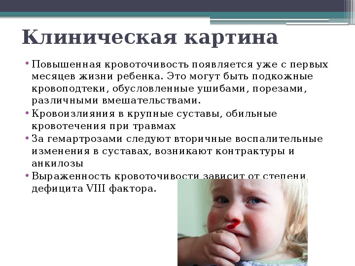 Ушиб клиническая картина