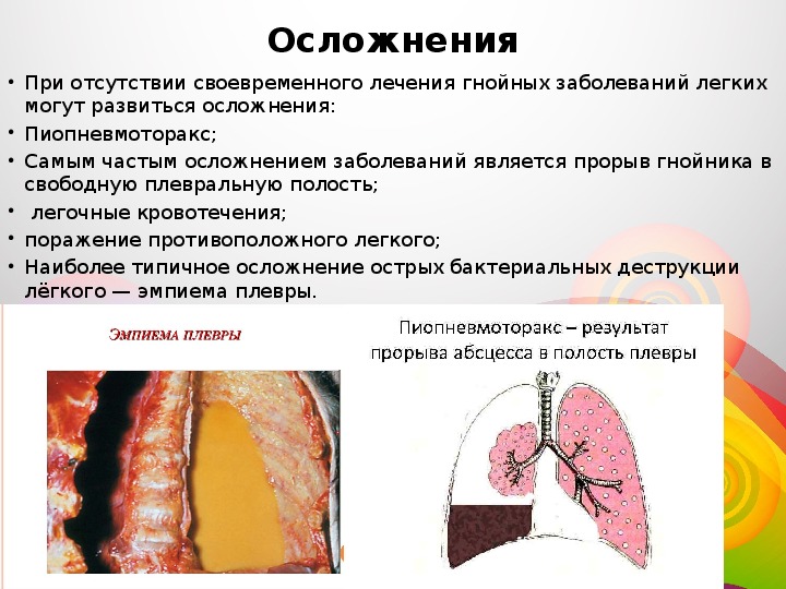 Гнойные заболевания легких презентация