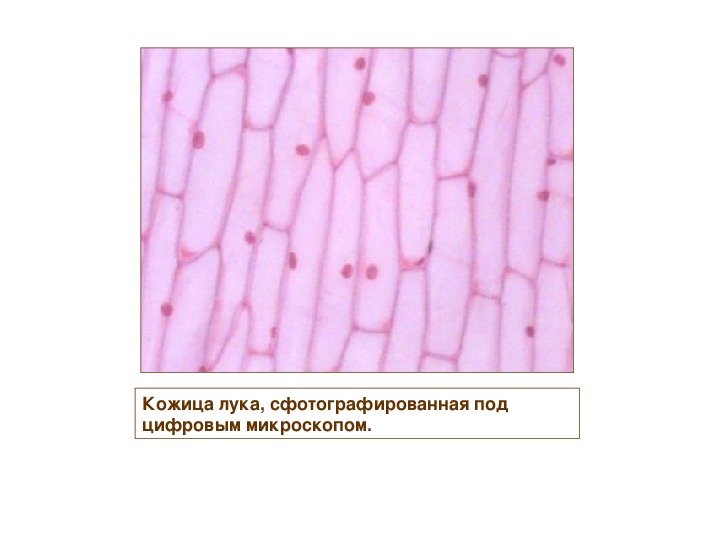 Лук под микроскопом 5 класс. Плазмолиз в клетках лука. Плазмолизированные клетки чешуи лука. Плазмолиз в клетках кожицы лука. Деплазмолиз клеток лука.