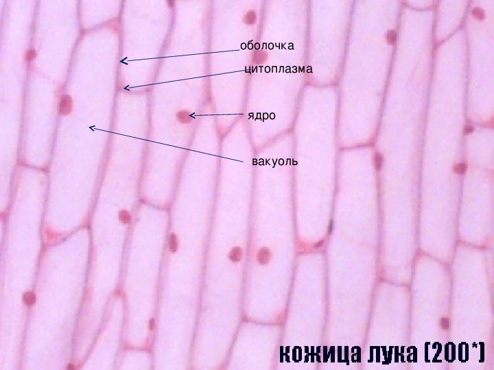 Слизистая оболочка клеток решетчатых лабиринтов