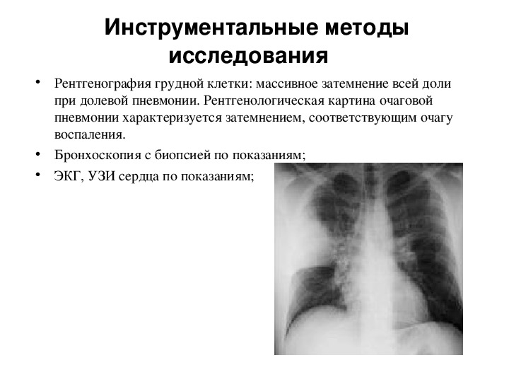 Инструментальные методы дыхательной системы. Инструментальные методы обследования бронхиальной астмы. Инструментальные методы исследования при очаговой пневмонии. Инструментальные методы исследования крупозной пневмонии. Инструментальные методы исследования при долевой пневмонии.