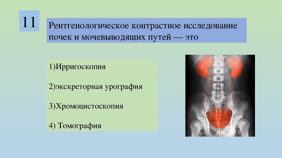 Инструментальные методы исследования почек и мочевыводящих путей презентация