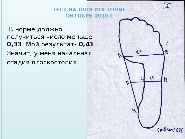 Проект плоскостопие 9 класс