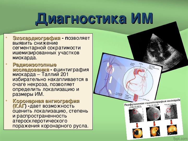 Эхокардиография сердца презентация