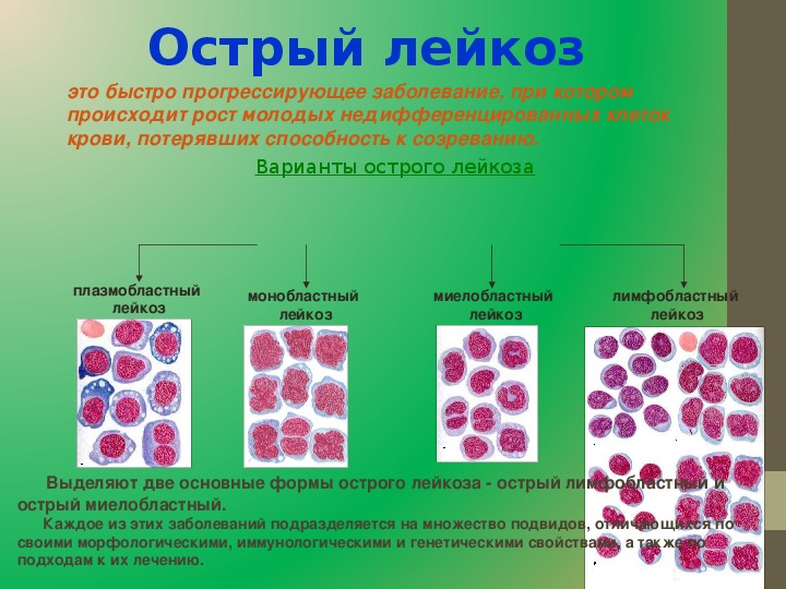 Для общего плана строения кроветворных органов не характерны признаки