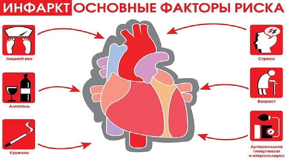 Вторичная профилактика инфаркта миокарда презентация