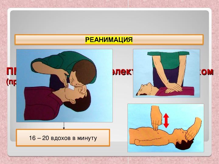 Презентация первая помощь при поражении ахов