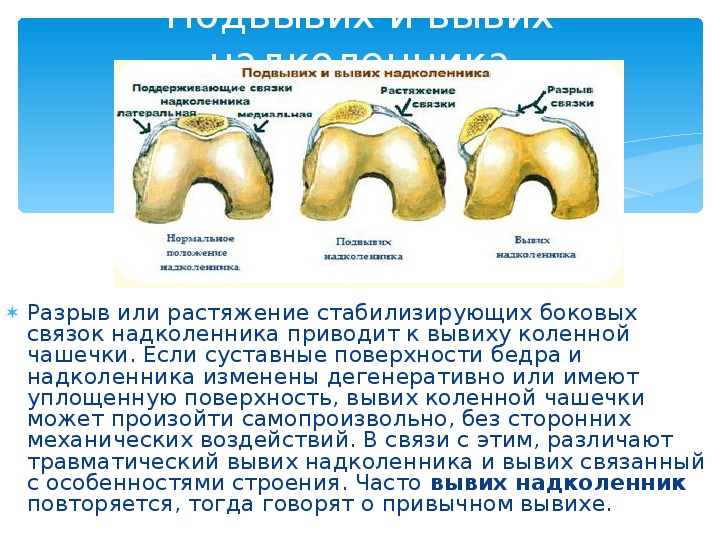 Ушиб надколенника карта вызова