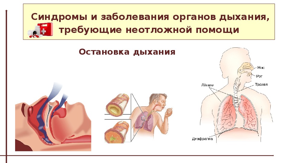 Презентация на тему неотложная помощь