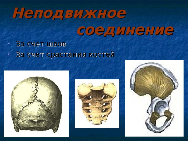 Какие из перечисленных костей соединены неподвижно. Неподвижное соединение костей. Швы соединения костей. Вколачивание соединение костей. Тип соединения костей с помощью швов.