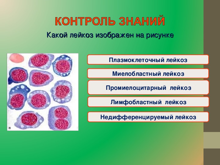 Для общего плана строения кроветворных органов не характерны признаки