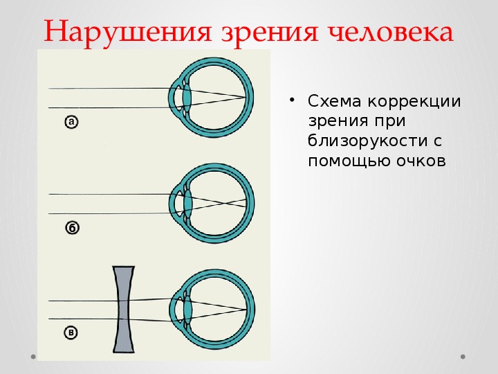 Зрение 8. Зрение минус 8. Физиология центрального зрения. Виды коррекции зрения физиология.