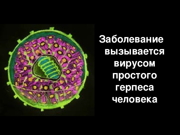 Презентация на тему герпес вирус