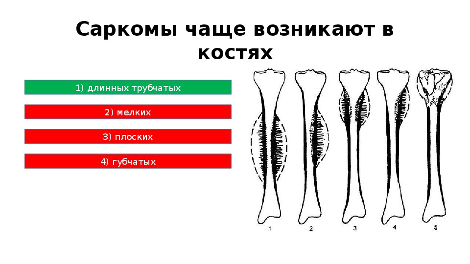 Реабилитация в онкологии презентация