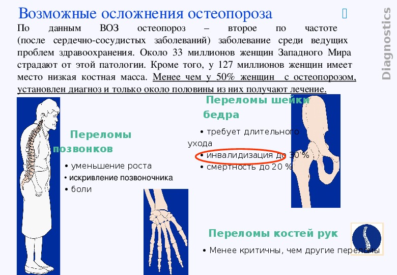 Разряжение костной ткани. Осложнения остеопороза. Осложнения остеопетроза. Остеопороз осложняется.