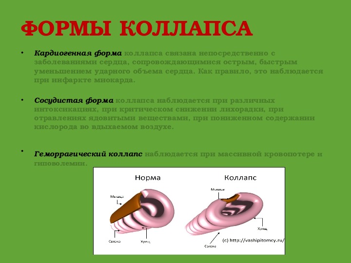 Сборка коллапса