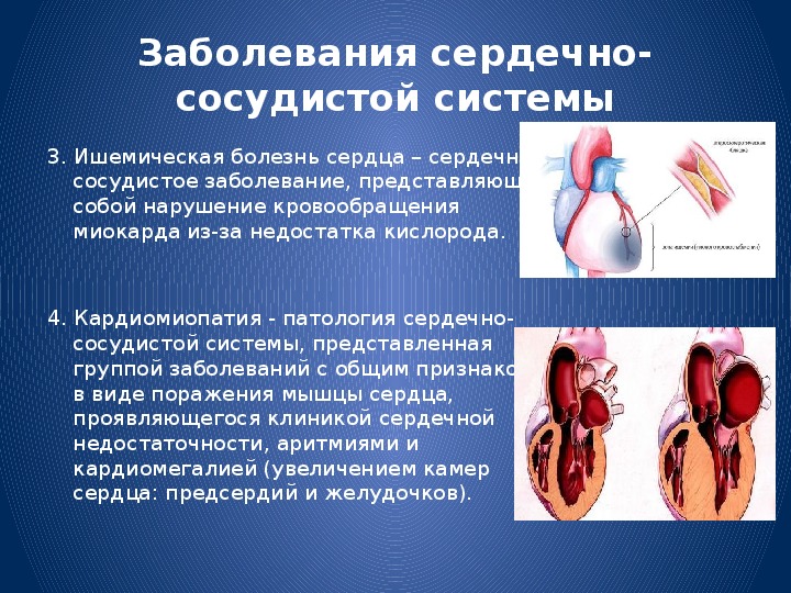 Причины болезней системы кровообращения
