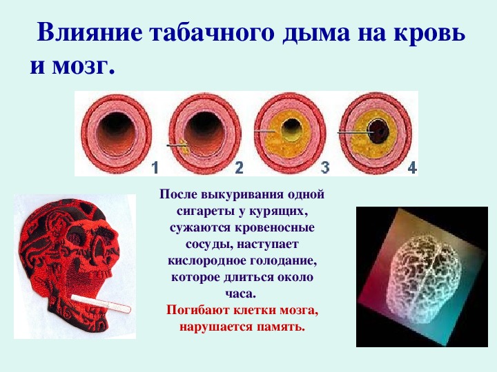 Влияние курения табака на кровеносную. Влияние никотина на кровеносную систему. Влияние курения на кровеносную систему человека. Влияние курения табака на кровеносную систему.