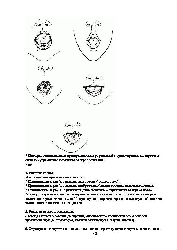 Логомассаж при дизартрии схема последовательность