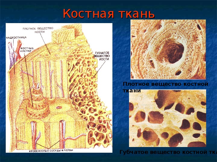 Трабекулярный рисунок кости