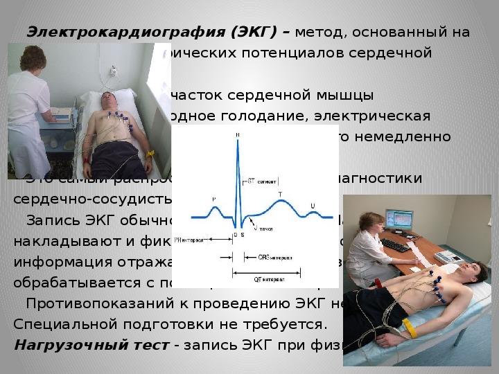 Экг презентация для медсестер