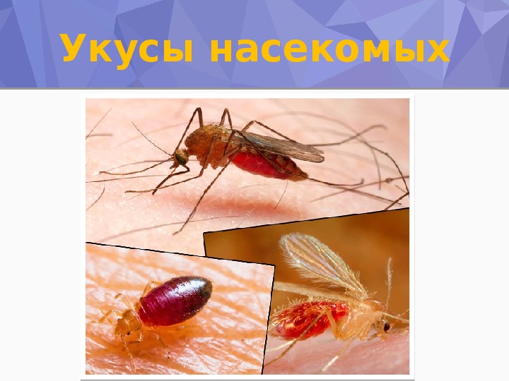 Укусы насекомых рисунок