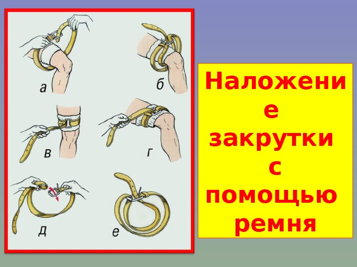 Наложение жгута на бедро. Наложение жгута из косынки. Техника наложения закрутки. Наложение закрутки на плечо. Наложение кровоостанавливающего жгута закрутки на бедро и плечо.