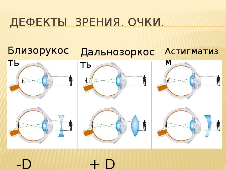 Очки и линзы презентация