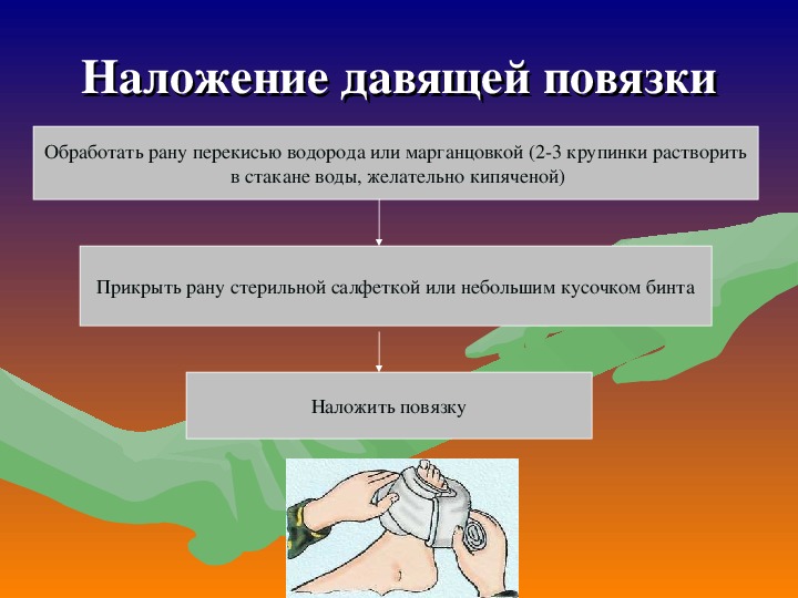 Давящие сроки. Правило наложение давящей повязки. Порядок действий при наложении давящей повязки.