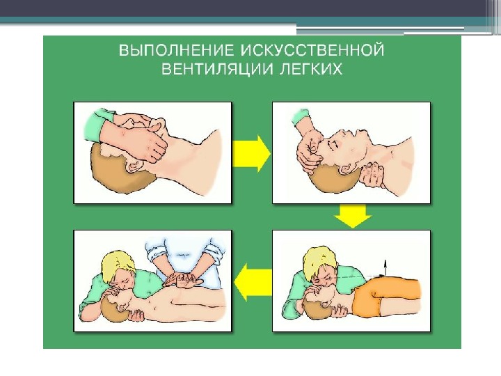 Сердечно легочная реанимация презентация обж