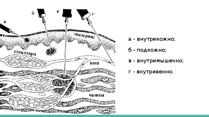 Пути и способы введения лекарственных средств схема