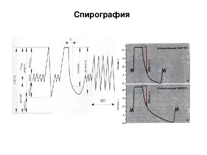 1 нарисовать спирограмму