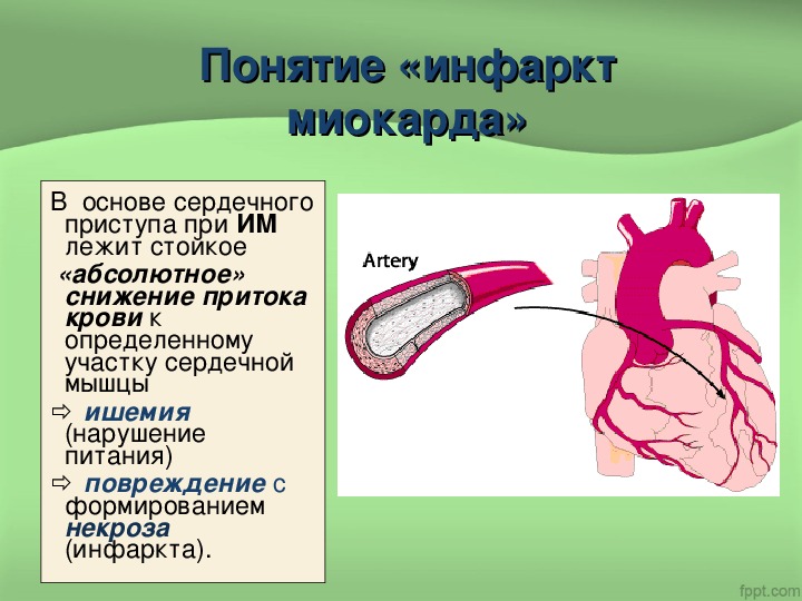 Лекция презентация инфаркт миокарда