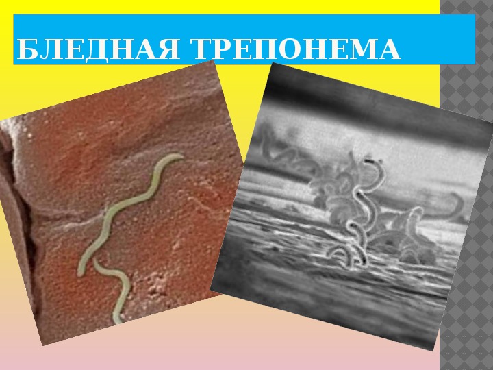 Бледная трепонема treponema pallidum. Спирохета бледная трепонема. Бледная трепонема строение.