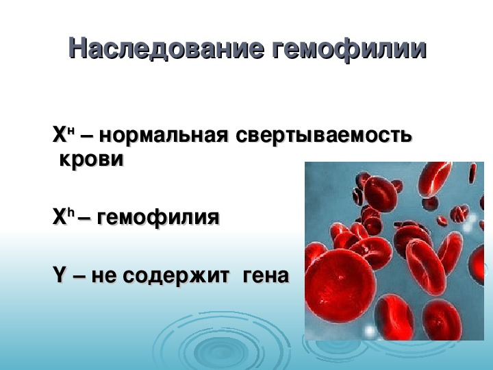Гемофилия h. Гемофилия и заболевание крови. Клинические проявления гемофилии. Гемофилия презентация.