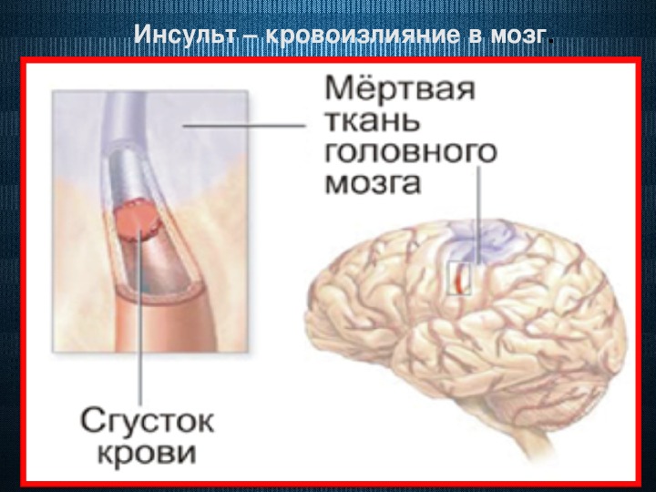 Первая помощь при острой сердечной недостаточности проект по обж